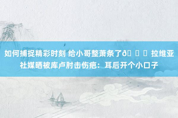 如何捕捉精彩时刻 给小哥整萧条了😅拉维亚社媒晒被库卢肘击伤疤：耳后开个小口子